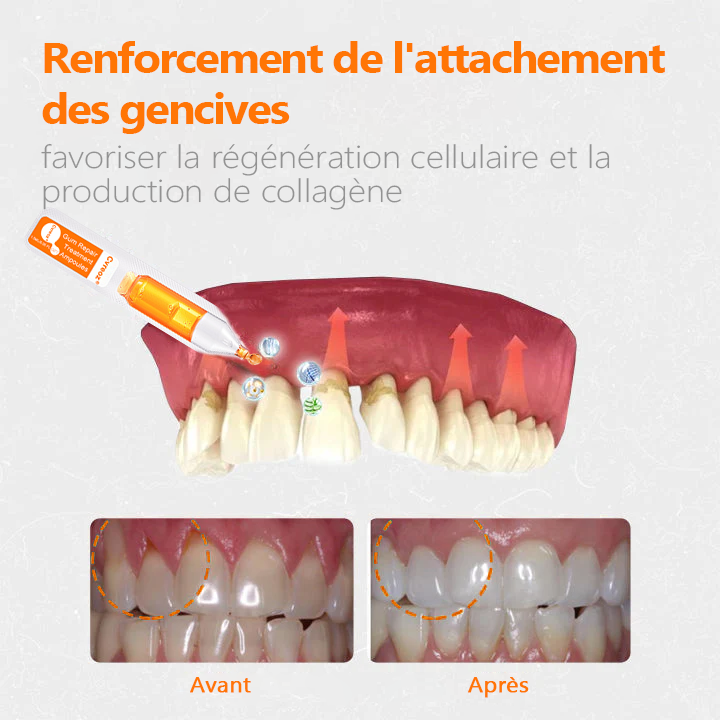 👑👑Flacons de traitement Cvreoz® pour la réparation des gencives