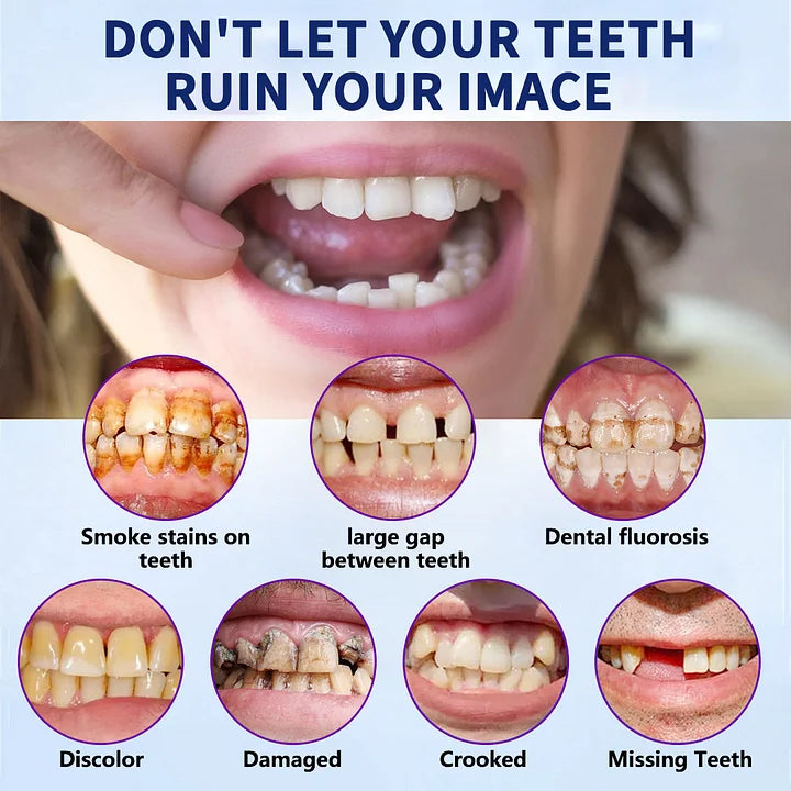 Bikenda™-🦷Advanced Customized Full Denture Set🦷 -Canadian Dental Association Certification(⏰Limited Time Discount Last 30 Minutes⏰)🌈🌈