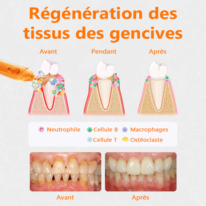 👑👑Flacons de traitement Cvreoz® pour la réparation des gencives