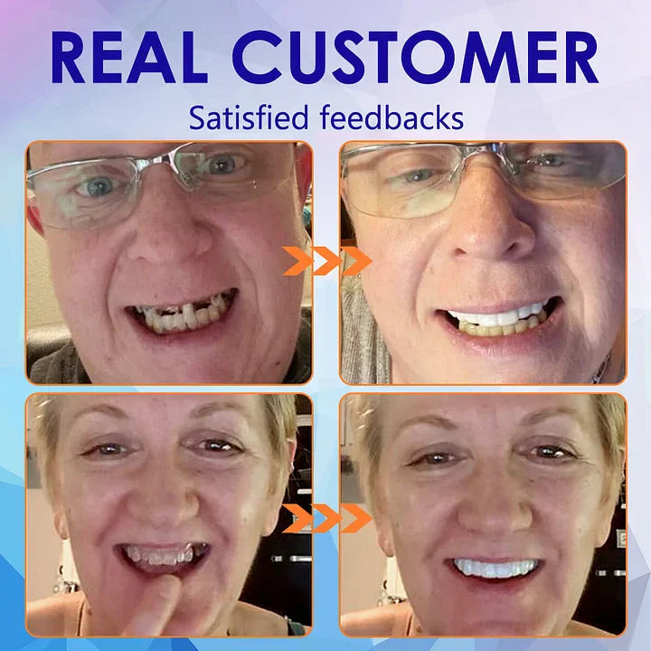 Bikenda™-🦷Advanced Customized Full Denture Set🦷 -Canadian Dental Association Certification(⏰Limited Time Discount Last 30 Minutes⏰)🌈🌈