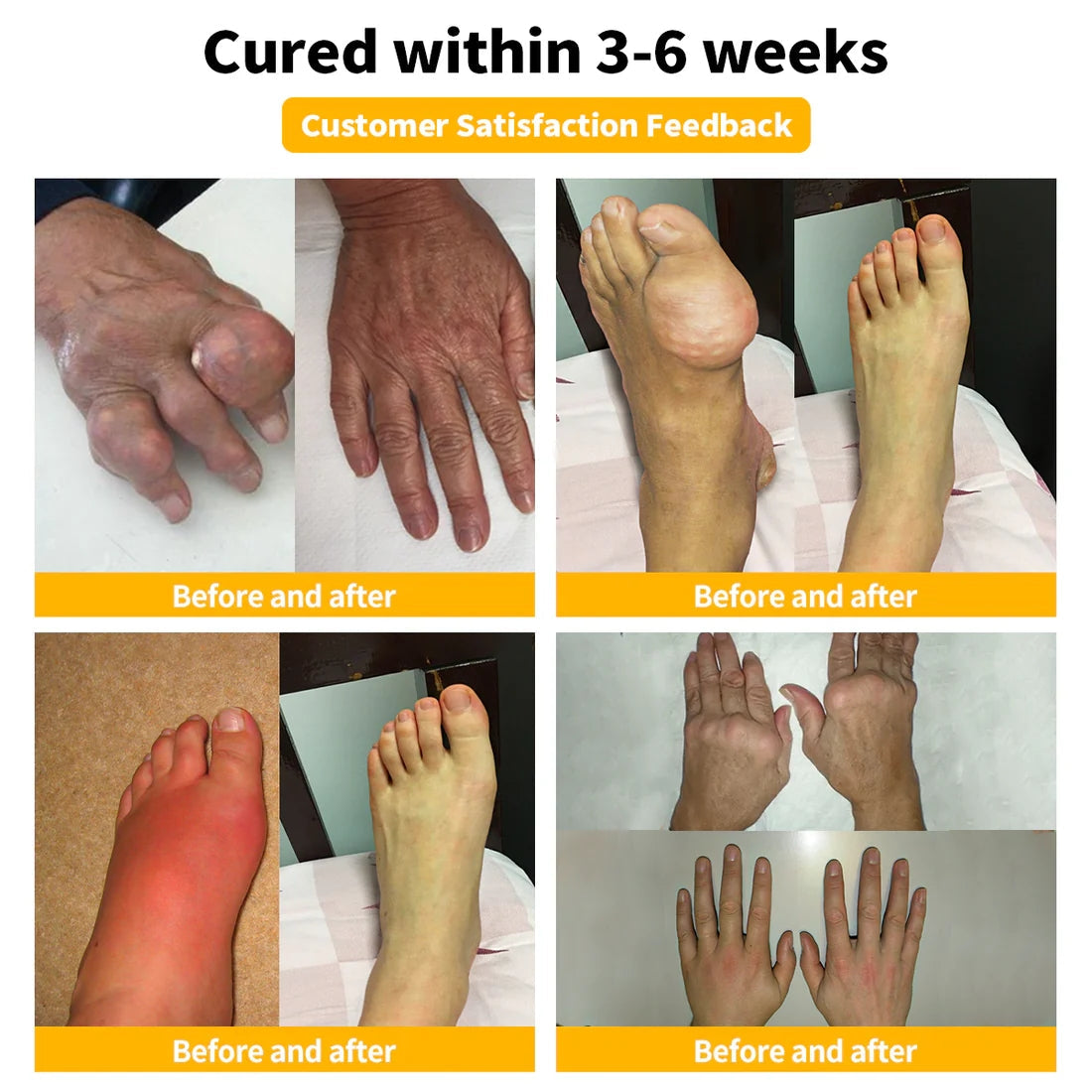 ✨✨𝗟𝗘𝗙𝗨𝗡® Bee Venom Bone Repair Cream (especially for older adults)