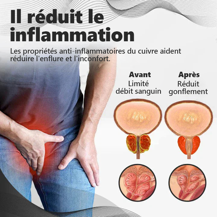 【 ✨Boutique officielle de la marque ✨】CZTICLE™ CopperMag Anneau de thérapie de la prostate👑👑