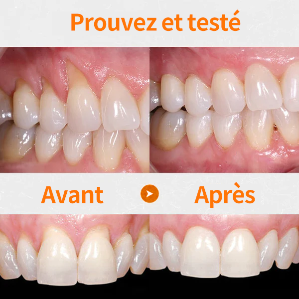 👑👑Flacons de traitement Cvreoz® pour la réparation des gencives