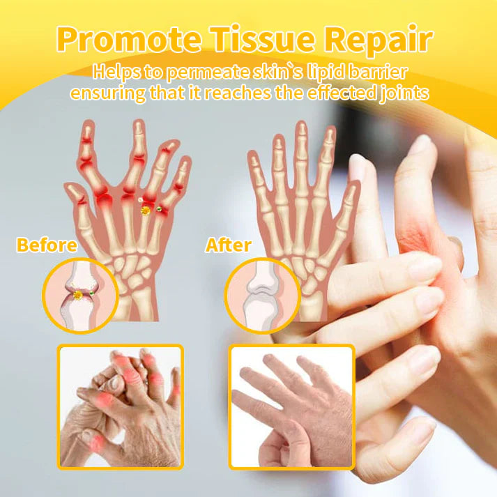 ✨✨𝗟𝗘𝗙𝗨𝗡® Bee Venom Bone Repair Cream (especially for older adults)