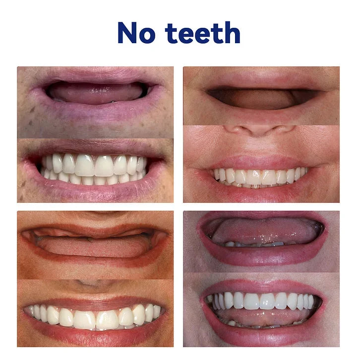 Bikenda™-🦷Advanced Customized Full Denture Set🦷 -Canadian Dental Association Certification(⏰Limited Time Discount Last 30 Minutes⏰)🌈🌈