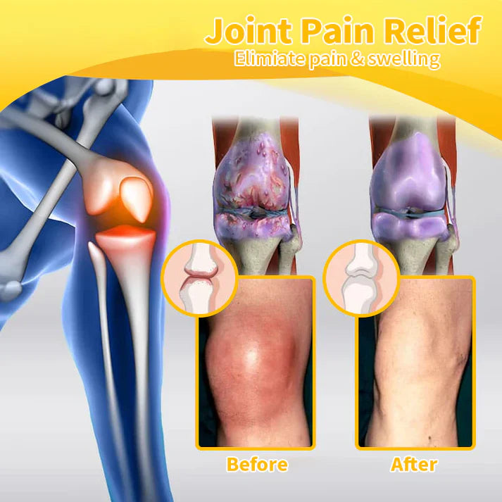 ✨✨𝗟𝗘𝗙𝗨𝗡® Bee Venom Bone Repair Cream (especially for older adults)