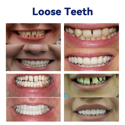𝗛𝗘𝗔𝗧𝗪𝗢𝗟𝗙™-🦷Advanced Customized Full Denture Set🦷 Canadian Dental Association Certification(⏰Limited Time Discount Last 30 Minutes⏰)💎💎