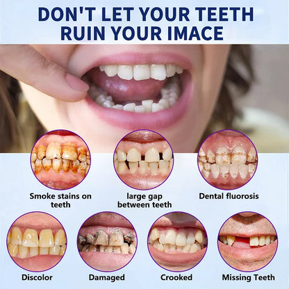 𝐁𝐢𝐤𝐞𝐧𝐝𝐚™-🦷𝐀𝐝𝐯𝐚𝐧𝐜𝐞𝐝 𝐂𝐮𝐬𝐭𝐨𝐦𝐢𝐳𝐞𝐝 𝐅𝐮𝐥𝐥 𝐃𝐞𝐧𝐭𝐮𝐫𝐞 𝐒𝐞𝐭🦷 (🔥Limited time discount last 30 minutes🔥)👑👑