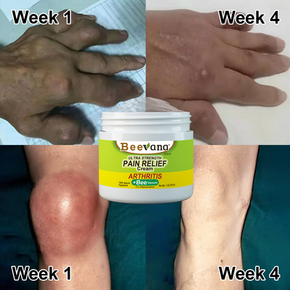 [🍀🍀Last day promotion 80% off🐝]Beevana™ Bee Venom Joint & Bone Therapy Cream (Full Body Recovery, Pure Natural Formula)x