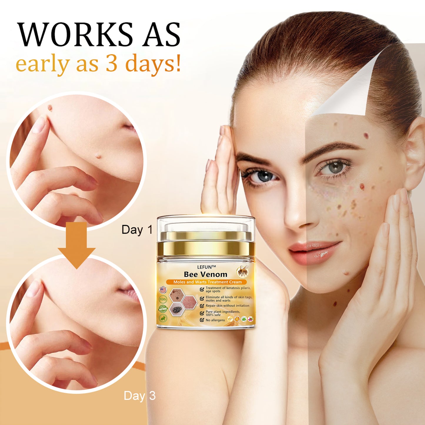 [🍀🍀Official Brand Shop🐝] LEFUN™Bee Venom Mole and Wart Treatment Cream(👨‍⚕AAD RECOMMENDS)x