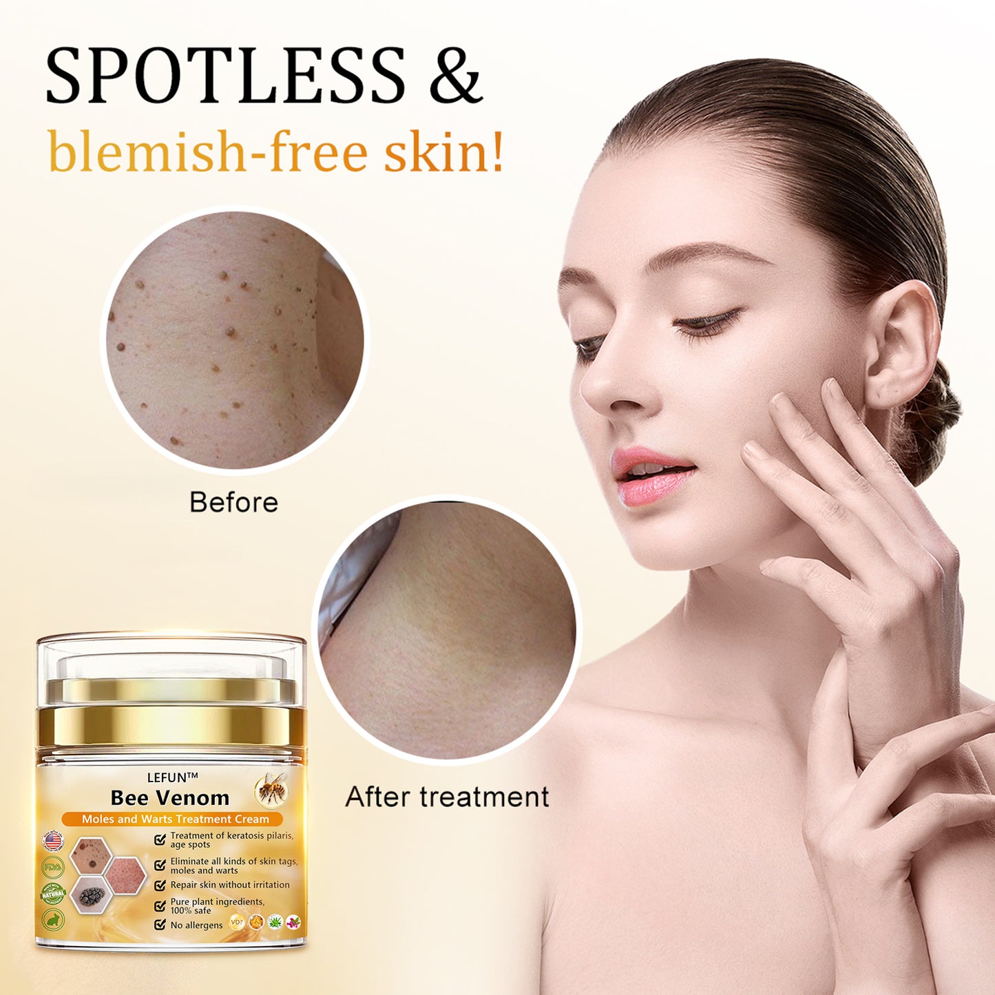 [🍀🍀Official Brand Shop🐝] LEFUN™Bee Venom Mole and Wart Treatment Cream(👨‍⚕AAD RECOMMENDS)x
