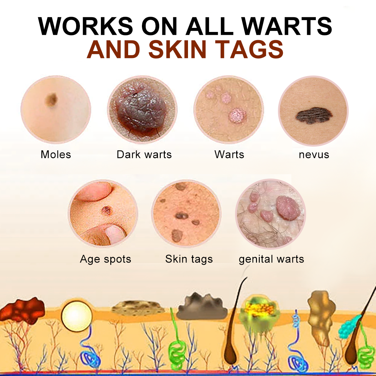 [🍀🍀Official Brand Shop🐝] LEFUN™Bee Venom Mole and Wart Treatment Cream(👨‍⚕AAD RECOMMENDS)x