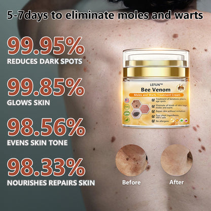 [🍀🍀Official Brand Shop🐝] LEFUN™Bee Venom Mole and Wart Treatment Cream(👨‍⚕AAD RECOMMENDS)x