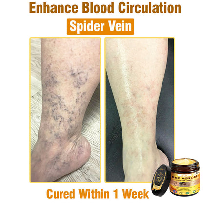 LEFUN™ Bee Venom All-in-One Cream US Dermatologist Approved-🔥🔥