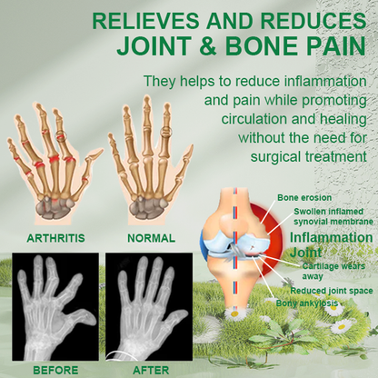 [🍀🍀Last day promotion 80% off🐝]Beevana™ Bee Venom Joint & Bone Therapy Cream (Full Body Recovery, Pure Natural Formula)x
