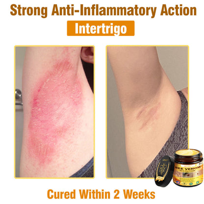 LEFUN™ Bee Venom All-in-One Cream US Dermatologist Approved-🔥🔥