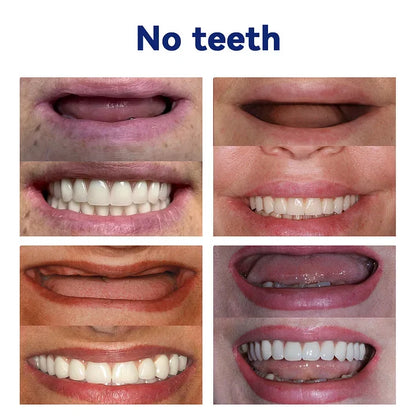 𝐁𝐢𝐤𝐞𝐧𝐝𝐚™-🦷𝐀𝐝𝐯𝐚𝐧𝐜𝐞𝐝 𝐂𝐮𝐬𝐭𝐨𝐦𝐢𝐳𝐞𝐝 𝐅𝐮𝐥𝐥 𝐃𝐞𝐧𝐭𝐮𝐫𝐞 𝐒𝐞𝐭🦷 (🔥Limited time discount last 30 minutes🔥)👑👑