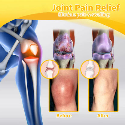 ✨✨𝗟𝗘𝗙𝗨𝗡® Bee Venom Bone Repair Cream (especially for older adults)